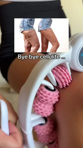 Absolute game changer !! #cellulite #cellulitereduction #lymphaticdrainage #celluliteroller #skinroller