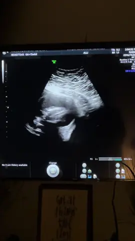 Secrets out 🤪🤰🏻 