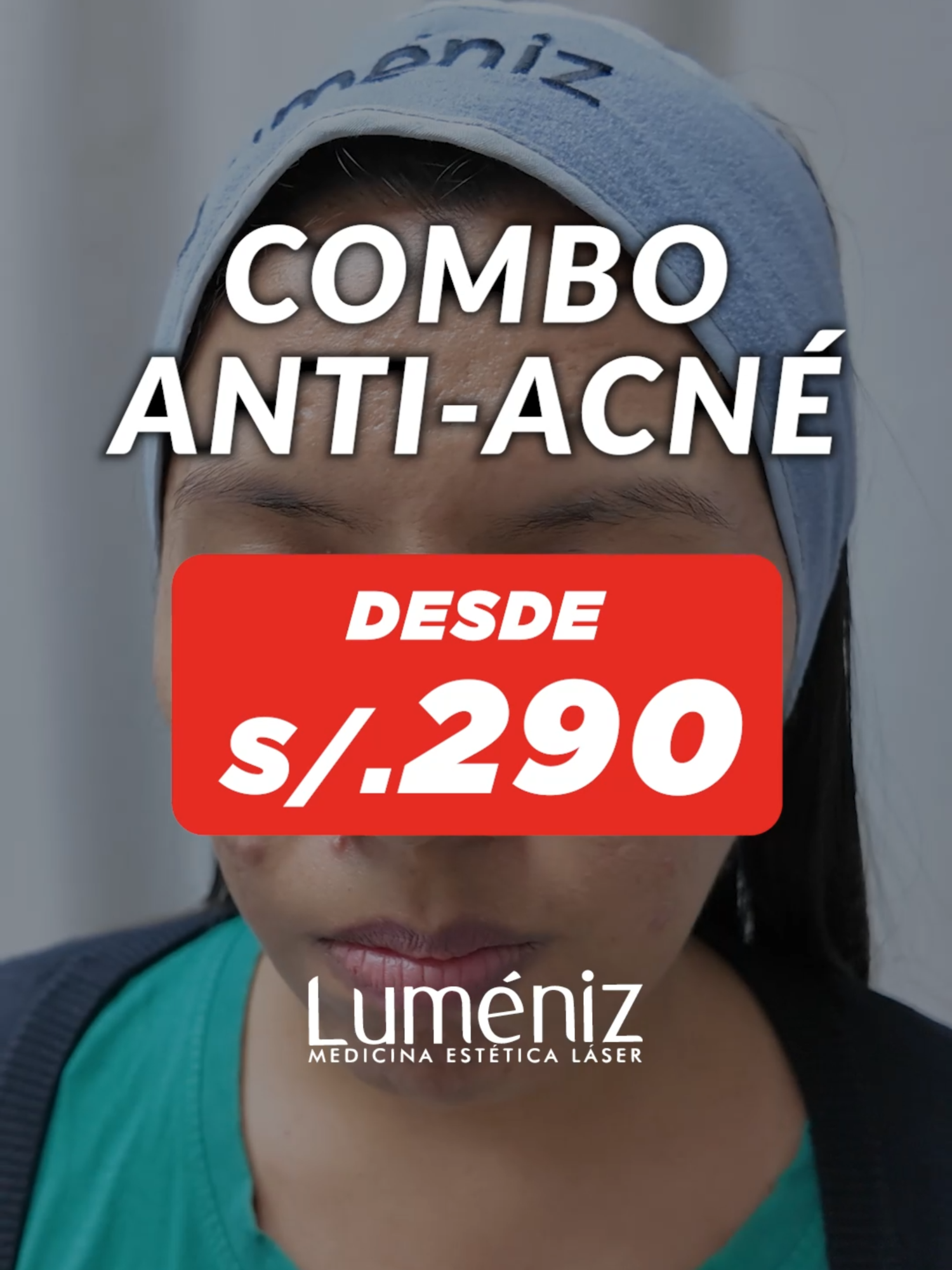 TRATA EL ACNÉ CON EL MEJOR TRATAMIENTO LÁSER 😱 Prueba el mejor protocolo para eliminar las impurezas: ✅Resultados rápidos y seguros ✅Controla la grasa facial ✅Purifica los poros ✅Sin interrumpir tus actividades diarias ✅Consulta GRATIS con nuestros médicos especialistas 📍 Visítanos en: Av. Benavides 1967 - Miraflores Lunes a Sábado, de 9:00 A.M. a 8:30 P.M. 986 742 307 / 994 023 520 #foryoupage❤️❤️ #paratii #trendy #esteticaa #Lumeniz #expertosenláser#acné #ACNÉ #AcnéActivo #LáserParaAcné #láserbactericida #AdiósAcné #CasosReales *Los tratamientos tendrán una vigencia hasta el 31 Agosto del 2025. Los pagos realizados no podrán ser reembolsados ni transferidos a terceros. En caso se adquiera un paquete, una vez culmine, la renovación será con los precios vigentes en esa fecha. Se aplican cambios sin previo aviso. Imágenes referenciales. Evaluación previa. Promociones con pago en efectivo.