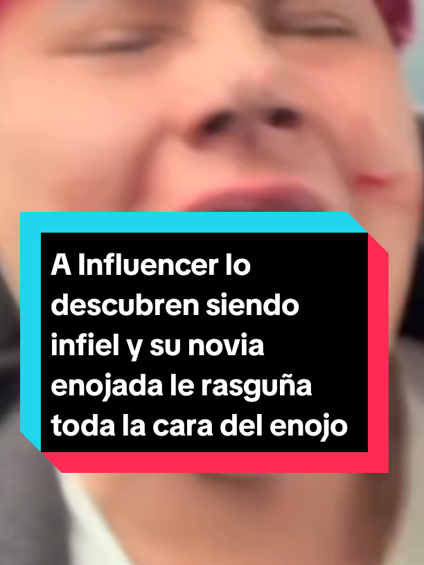 Le descubren que esta siendo infiel y su pareja le rasguña toda la cara #joshuaanloza #luceroserpa #fyp #viral #chismestiktok 