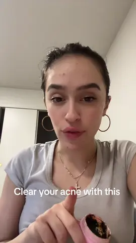 Clear acne #acne #skincare #acneproneskin  #creatorsearchinsights 