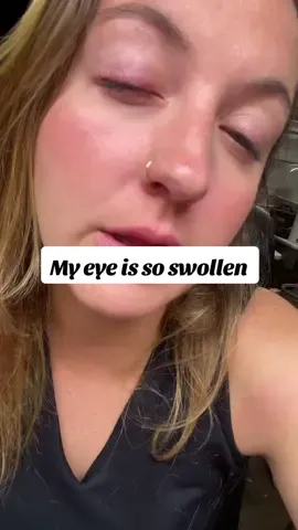 Ragweed allergy season is the absolute worst for me! Anyone else? #ragweed #allergies #allergyseason #antihistamine #fyp  