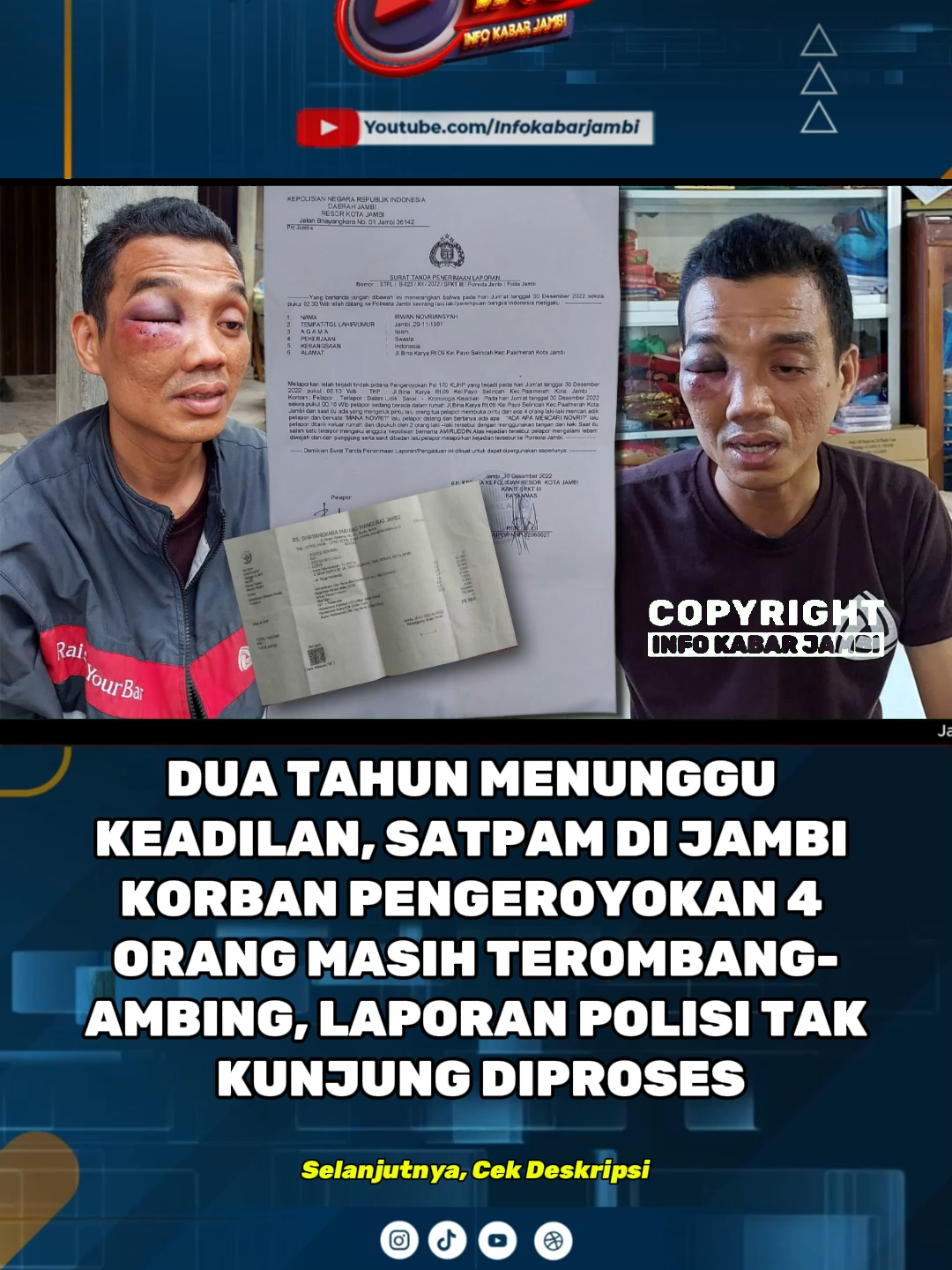 Kasus Pengeroyokan Irwan Novriansyah, Sudah 2 Tahun Tanpa Kepastian Hukum INFO KABAR JAMBI – Kasus dugaan pengeroyokan yang dialami oleh Irwan Novriansyah, seorang warga Kota Jambi, hingga kini masih belum menemui titik terang meski sudah lebih dari dua tahun berlalu sejak dilaporkan ke pihak kepolisian. Peristiwa tersebut terjadi pada Jumat, 30 Desember 2022, sekitar pukul 00.10 WIB di kediaman korban di Jl. Bina Karya RT 09, Kelurahan Payo Selincah, Kecamatan Paalmerah, Kota Jambi. Berdasarkan Surat Tanda Penerimaan Laporan (STPL) Nomor: STPL/B-623/XII/2022/SPKT III/Polresta Jambi/Polda Jambi, korban yang melapor bernama Irwan Novriansyah, lahir di Jambi pada 29 November 1981, beragama Islam, bekerja sebagai swasta, beralamat di Jl. Bina Karya RT 09 Payo Selincah, Paalmerah, Kota Jambi. Dalam laporannya, Irwan menjelaskan bahwa saat tiba di rumah usai bertugas patroli sebagai satpam vendor Sigap Jambi untuk Maybank, ia didatangi oleh empat orang tak dikenal yang langsung melakukan pemukulan. Salah satu pelaku sempat menanyakan, “Ada yang mencari Novri?” sebelum kemudian korban dikeroyok hingga babak belur. Korban berhasil menyelamatkan diri ke dalam rumah, namun para pelaku terus melakukan penganiayaan. Irwan menyebut salah satu pelaku diketahui bernama Amiruddin. Atas kejadian itu, Irwan kemudian membuat laporan resmi ke Polresta Jambi. Sayangnya, meski laporan telah dibuat sejak 2022 lalu, hingga kini korban mengaku belum mendapatkan kejelasan penanganan dari pihak kepolisian. Upaya Irwan untuk menanyakan perkembangan kasusnya secara berulang kali pun belum membuahkan hasil. Korban berharap agar aparat penegak hukum dapat segera menindaklanjuti kasus pengeroyokan ini dan memberikan kepastian hukum, mengingat peristiwa yang menimpanya sudah berlangsung lebih dari dua tahun tanpa penyelesaian.