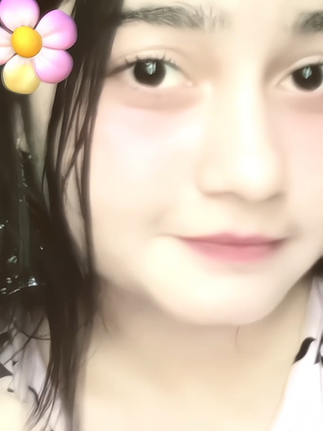 eyes 🥲      #Foryou #foryou #foryoupage #fyppppppppppppppppppppppp #fyp @TikTok @For You @For You House ⍟ @TikTok Bangladesh @TikTok Trends @tiktok creators 