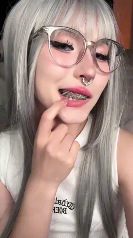Oops.. #fyp #asian #trends #cute #braces 