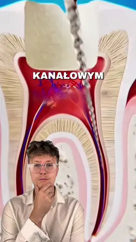 Problemy podczas leczenia kanałowego i jak na to zaradzić. Link do zakupu szczoteczki znajduje się w opisie mojego profilu. Aktualnie trwa na nią promocja -50%!