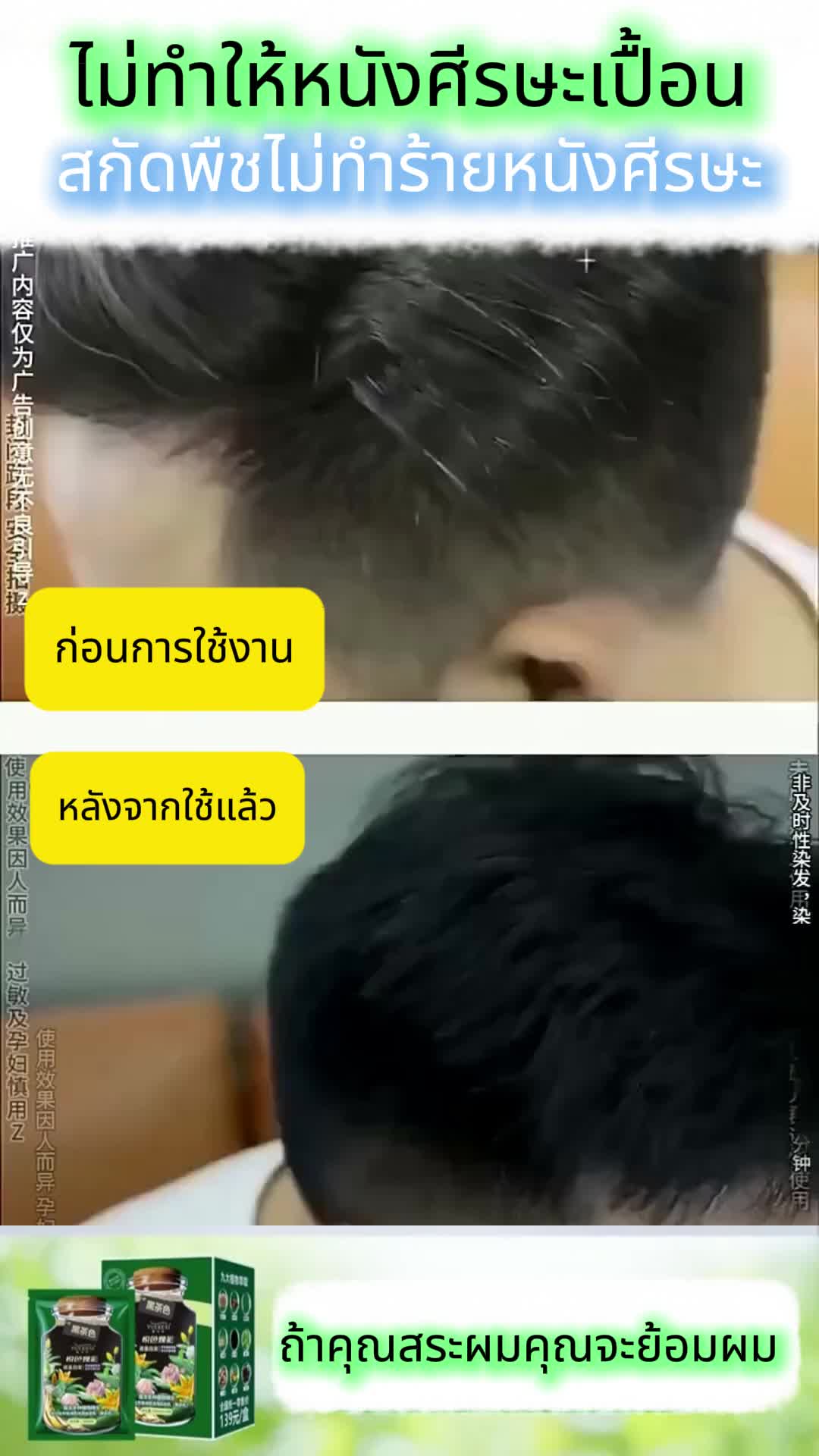 สีผมที่ไม่ทำลายสุขภาพหนังศีรษะ 
