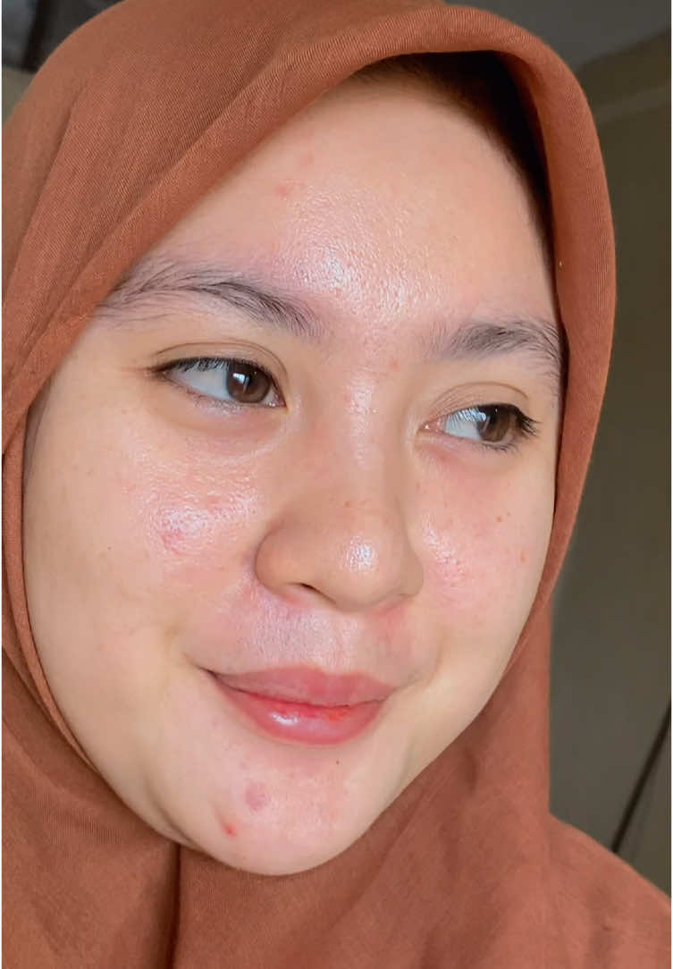 Udah lama ya ga fyp😭