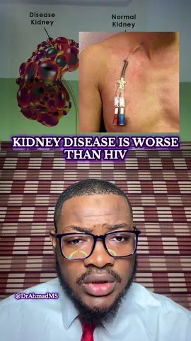 Do not take your kidneys for granted 