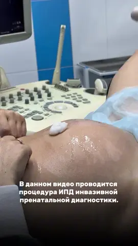 Как точно узнать, есть ли синдром Дауна у малыша? V Для этого проводится инвазивная пренатальная диагностика (ИПД): - биопсия хориона (с 10-15 недели) - амниоцентез (с 16-20 недели) Эти методы позволяют с высокой точностью выявить или исключить хромосомные и другие генетические нарушения. • Когда рекомендуется ИПД? Показания к ИПД могут включать: • Возраст будущей мамы старше 35 лет • Положительные результаты скринингов (УЗИ или биохимия) • Наличие генетических заболеваний в семье • Отягощённый акушерский анамнез (например, рождение ребёнка с генетическими патологиями в прошлом) • Хромосомные нарушения у родителей (носительство транслокаций и др.) Важно помнить: Не стоит паниковать и делать выводы самостоятельно. Каждая беременность - индивидуальна. Обратитесь к врачу-генетику. Мы пройдём этот путь вместе — спокойно, профессионально и с заботой.#fürdich #рекомендации 