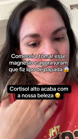 Cara de bolacha ou rosto de cortisol? Aqui não 💁‍♀️ O seu cortisol alto ta acabando com sua beleza, amiga! Bora cuidar logodisso 😉🩵  #cortisol #estresse #magnesio #inchaço #foryou