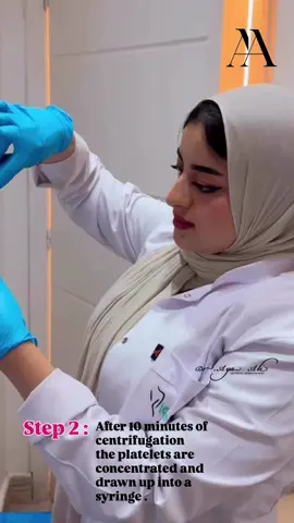 ✨✨ PRP ✨✨ ▪️فوائد حقن البلازما للبشره : تجديد خلايا البشره - تقليل التجاعيد والخطوط في البشره - تحسين نضاره البشره - علاج آثار حب الشباب والندبات - ▪️Benefits of plasma : - Skin rejuvenation - ⁠Reduction of wrinkles and fine lines - ⁠Enhanced skin glow - ⁠scar and acne mark improvement For reservations : - send Dm 📩 Or -whatsapp 01055774622 #plasmainjections  #plasma #dermatology #plasma 