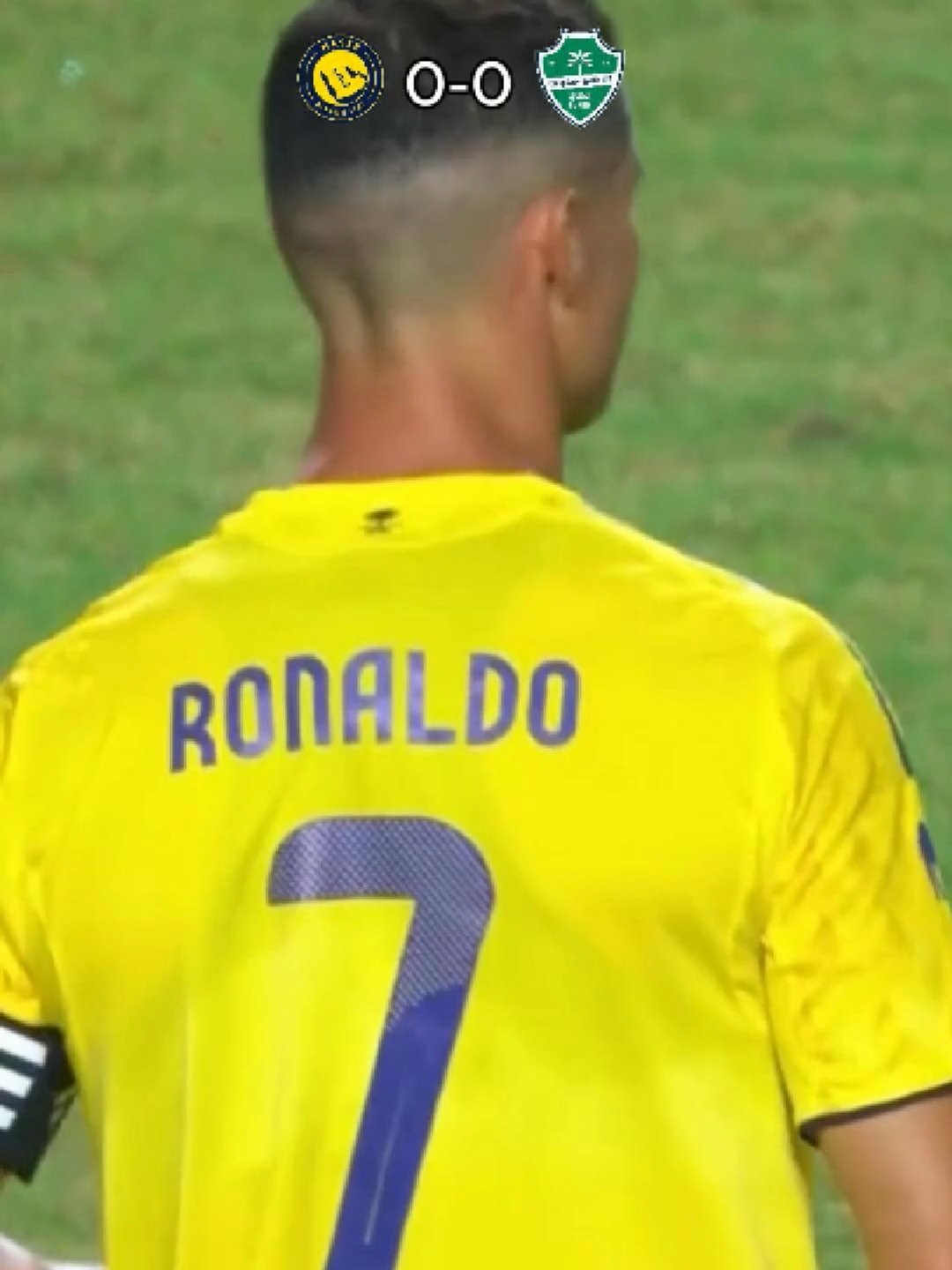 Al Nassr vs Al Ahli 2-2 (PEN 3-5) - All Goals & Highlights - Supper Cup FINAL 2025 🔥 Ronaldo Goal Al Nassr vs Al Ahli Al Nassr vs Al Ahli 2-2  Al Nassr vs Al Ahli Highlights Al Nassr vs Al Ahli Goal Al nassr vs Al Ahli Golos Al Nassr vs Al Ahli Goles Al Nassr vs Al Ahli Resumen Al Nassr vs Al Ahli Resumo Cristiano Ronaldo Goal  João Félix Goal Sadio Mané Goal Al Nassr Al Ahli, Al Nassr vs Al Ahli full match, Al Nassr Al Ahli Premier League 2025, Al Nassr Al Ahli live streaming, Al Nassr Al Ahli kickoff time, Al Nassr Al Ahli, Al Nassr Al Ahli highlights, Al Nassr Al Ahli football today, Al Nassr Al Ahli EPL clash, Al Nassr Al Ahli team news, Al Nassr Al Ahli match preview, Al Nassr Al Ahli tactical analysis, Al Nassr Al Ahli fans reaction, Al Nassr Al Ahli Anfield stadium, Al Nassr Al Ahli stadium atmosphere, Al Nassr Al Ahli press conference, Al Nassr Al Ahli goals replay, Al Nassr Al Ahli live coverage, Al Nassr Al Ahli commentary, Al Nassr Al Ahli fan zone, Al Nassr Al Ahli HD live, Al Nassr Al Ahli highlight, Al Nassr Al Ahli watch in HD, Al Nassr Al Ahli match moments, Al Nassr Al Ahli today live, Al Nassr Al Ahli on ABHI YT, Al Nassr Al Ahli top goals, Al Nassr Al Ahli football intensity, Al Nassr Al Ahli starting XI, Al Nassr Al Ahli referee, Al Nassr Al Ahli pre-match analysis, Al Nassr Al Ahli post-match review, Al Nassr Al Ahli reaction video, Al Nassr Al Ahli EPL rivalry, Al Nassr Al Ahli league table, Al Nassr Al Ahli season 2025, Al Nassr Al Ahli must-watch match, Al Nassr Al Ahli managers, Al Nassr Al Ahli match stats, Al Nassr Al Ahli free live stream, Al Nassr Al Ahli football passion, Al Nassr Al Ahli high-press game, Al Nassr Al Ahli attacking play, Al Nassr Al Ahli counter attack, Al Nassr Al Ahli matchday vlog, Al Nassr Al Ahli fan chants Cristiano Ronaldo reached a historic milestone by scoring his 100th goal for Al Nassr in the 2025 Saudi Super Cup Final against Al Ahli at Hong Kong Stadium. The match concluded in a 2-2 draw, with Ronaldo converting a penalty in the 41st minute. Franck Kessié equalized for Al Ahli just before halftime. The second half saw both teams battling intensely, but neither could secure the win. This final marked the first time the Saudi Super Cup was held outside the Middle East, highlighting the global expansion of Saudi football Cristiano Ronaldo Goal | Al Nassr vs Al Ahli SC | Highlights | Saudi Arabia Super Cup 25/26 Joao Felix Goal | Al Nassr vs Al Ahli SC | Highlights | Saudi Arabia Super Cup 25 Sadio Mane Red card | Al Nassr vs Al Ahli SC | Highlights and Goals | Saudi Arabia Super Cup 25 Sadio Mane Goal | Al Nassr vs Al Ahli SC | Highlights and Goals | Saudi Arabia Super Cup 25 Kingsley Coman Goal | Al Nassr vs Al Ahli SC | Highlights and Goals | Saudi Arabia Super Cup 25/26 Inigo Martinez Goal | Al Nassr vs Al Ahli SC | Highlights and Goals | Saudi Arabia Super Cup 25/26 Jhon Duran Goal | Al Nassr vs Al Ahli SC | Highlights and Goals | Saudi Arabia Super Cup 25/26 João Félix Goal | Al Nassr vs Al Ahli SC | Highlights and Goals | Saudi Arabia Super Cup 25/26 Marcelo Brozovic Goal | Al Nassr vs Al Ahli SC 2-1 | Highlights | Saudi Arabia Super Cup 2025/2026 al nassr vs al ahli sc saudi arabia super cup, al nassr out of saudi super cup, saudi pro league live al nassr, al ahli saudi fc vs al nassr, al nassr vs al ahli, al-ahli saudi football club al nassr saudi arabia super cup, al nassr super cup, al nassr out of saudi super cup, ronaldo saudi super cup, ronaldo saudi arabia cup al nassr vs al ahli sc, al nassr vs al ahli, al nassr vs al hazem, al ahli saudi fc vs al nassr, al nassr fc vs al ahli, al nassr vs al hazm, al nassr vs al ahli jeddah live, al nassr vs al  #alnassr #alnassr_fc #ronaldo #cristianoronaldo #cristianos #ronaldo7 #supercup #joaofelix #coman #goal #golas #fyp #footballtiktok #highlights #highlight #alahly #alahli #alahlifc