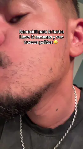 Síganme en mi journey para ver si consigo algo de barba #nanoxidil 