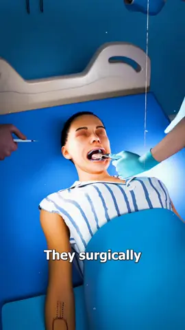 90% of her tongue removed… what she said first will shock you 😳 The end will surprise you . . . . . . #despardes #saidpurvillage #funny #fyp #meme 