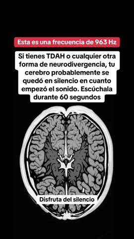 ¿Te ayudó a concentrarte o a detener los pensamientos acelerados? 🤔 EL MANUAL DEL TDAH 📖 tiene 134 estrategias que me ayudaron a pasar de apenas sobrevivir a realmente prosperar 🙌 Detalles en mi bi0 ❤️ #tdahadulto #ansiedad #tdah #vidacontdah #tdahespaña 
