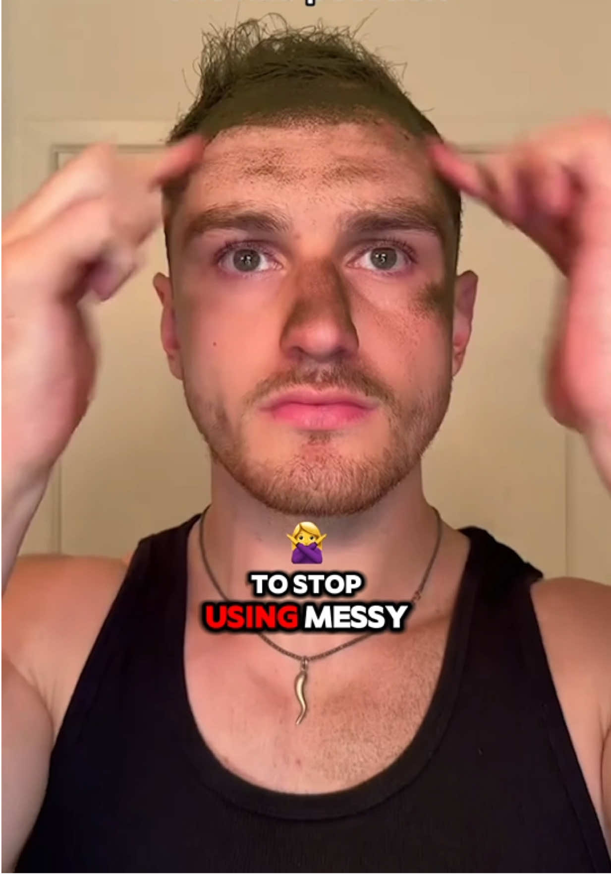 Link in bio. 🧡 #HairBear #hairtransformation #hairloss #hairtransplant #hairfibers 