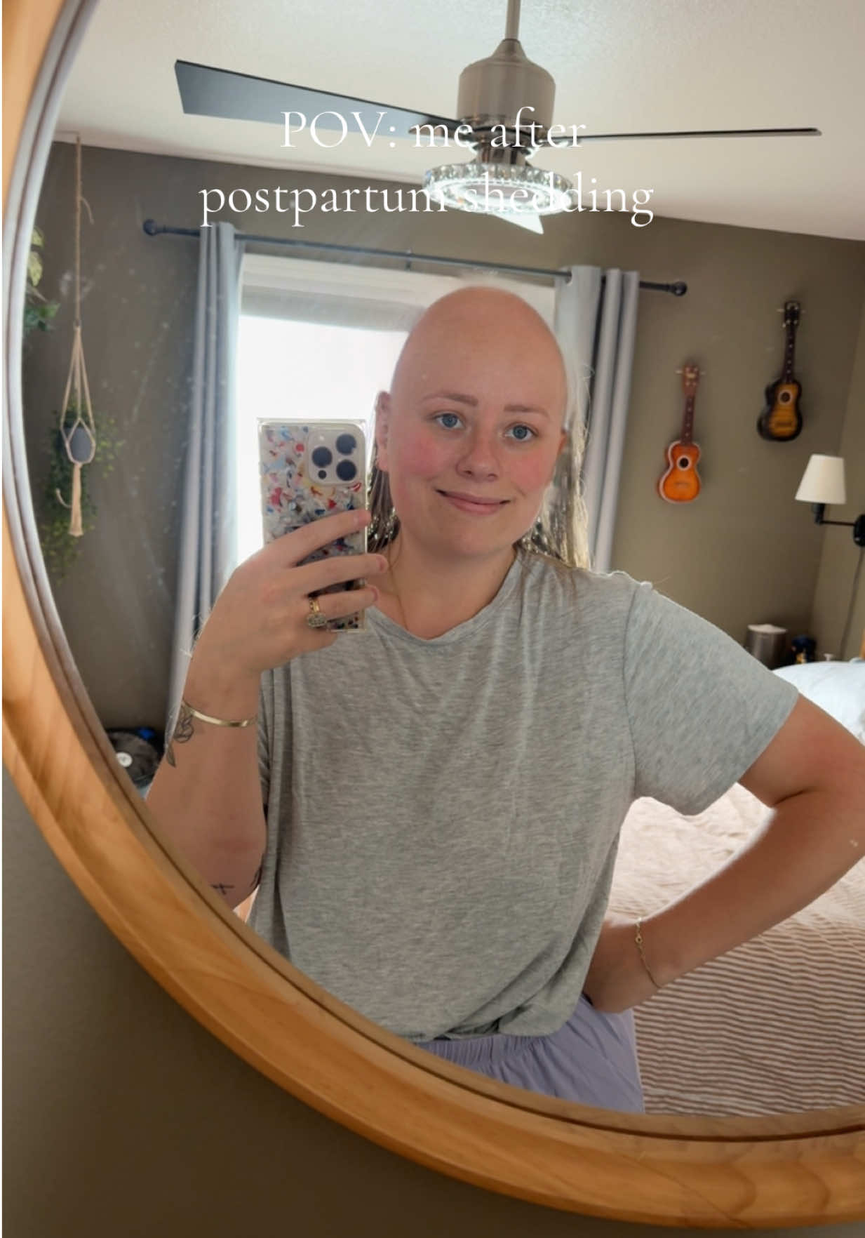 The most overstimulating part of having a baby is the hair that is everywhere but on my head 🌝 #postpartum #hairloss #sendhelp #momtok #bald  