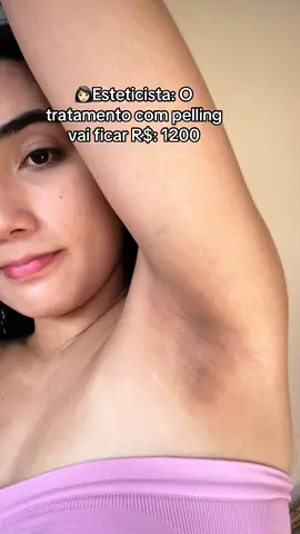 Só paga caro em clareamento de manchas quem não conhece esse clareador 😮‍💨 #dicasdebeleza #clareadordepele #manchas 