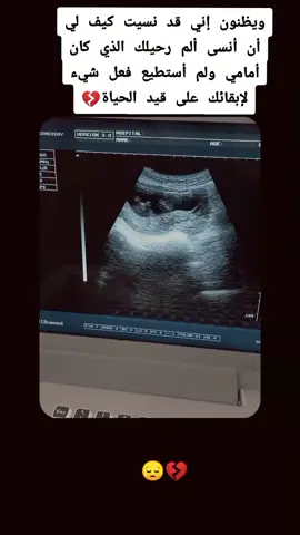 جربتي شعور تكوني تحملتي الكتير تحملتي الم ما بينحمل وضل القليل لتملي عينك بشوفة جنينك وتنسي كل الالم وفجأة تخسري😔💔اصعب شعور عشته بكل حياتي فقدتك يا قطعة من قلبي😔💔
