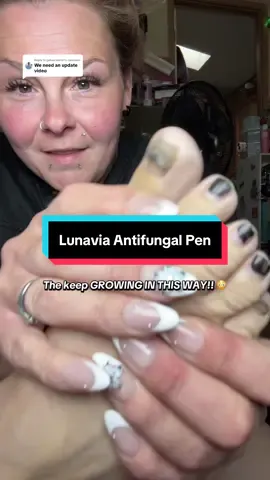 Replying to @gabes.world1 #lunaviaantifungalpen #antifungal #fungustoenail #nailfungus #tiktokshoplabordaysale 