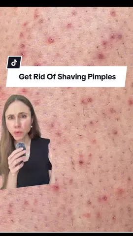 How to get rid of and prevent shave pimples. #shavingtips #shavinghacks #dermatologist #creatorsearchinsights  