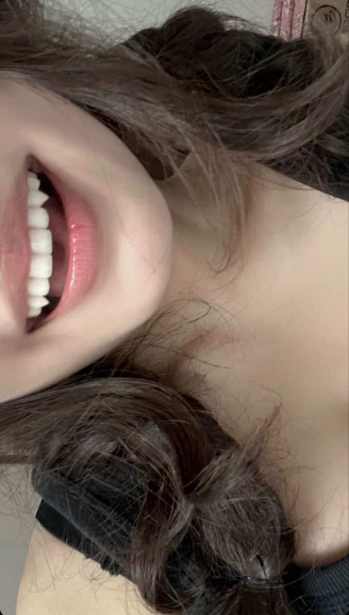 #teeth #edit #primaldiet #fyp #lookmaxing 