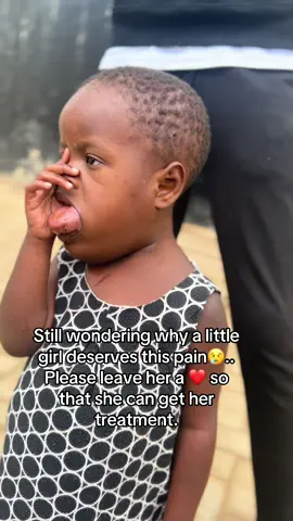 Even $2 count.Go fund me link in bio @ESCO Home Improvements LLC #FYP #ForYou #Viral #HelpALittleGirl #viralvideos #sickbaby #gofundme #fyp #fyppppppppppppppppppppppp #challenge #MakeAWish #goviral #beautiful 