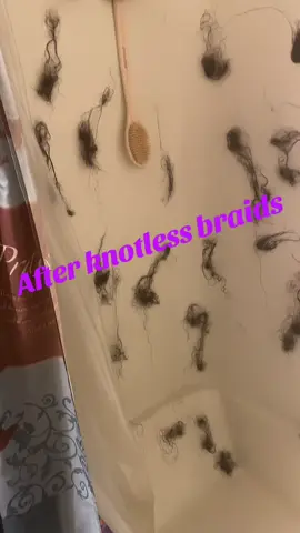 #knotlessbraids #hairloss #OhNo 