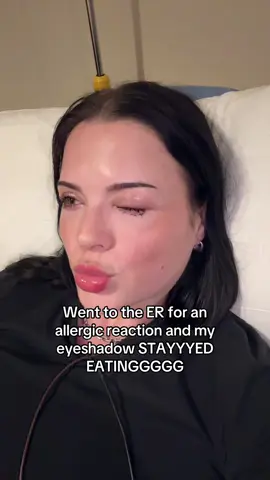 Slaying and swelling. PSA: This eyeshadow did NOT cause this. 