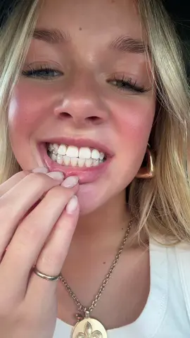 went and got tooth gems! 😋 #yup