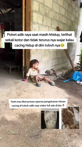 raya dpnuhi cacing #fakesituation #rayasukabumi #kangdedymulyadi #rayacacingdidalamtubuh #fyp