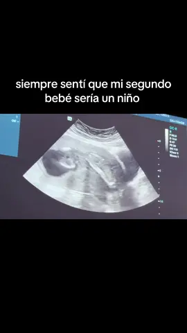 👶🏼💙  #ivfjourney 