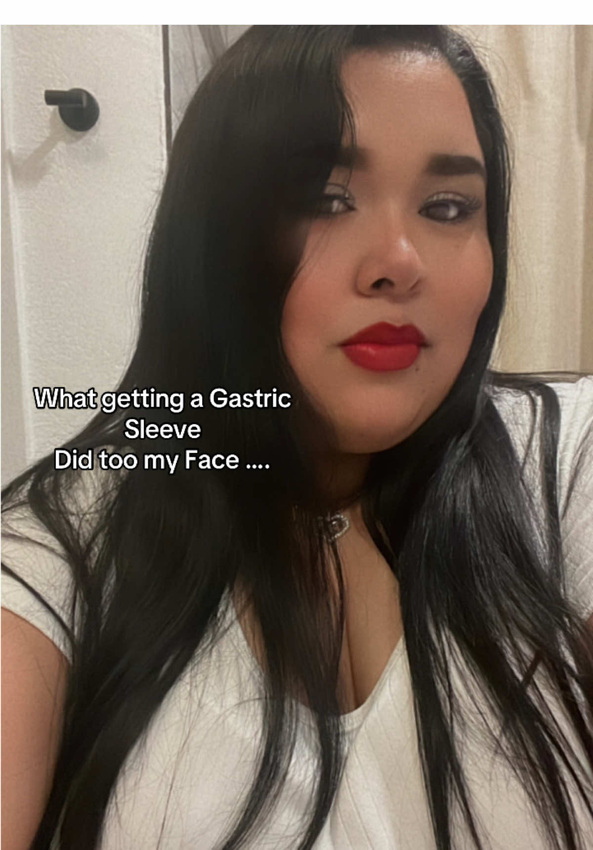 Im on top of the world 🌎 #gastricsleevetransformation #VSG #gastricsleevecommunity #SelfImprovement 