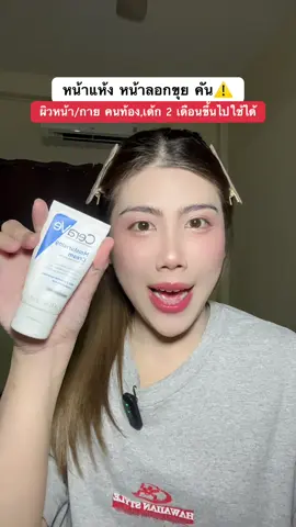 #cerave #มอยเจอร์ไรเซอร์ #แพ้สารสเตียรอยด์ #ผิวแห้ง #ผิวลอกเป็นขุย 