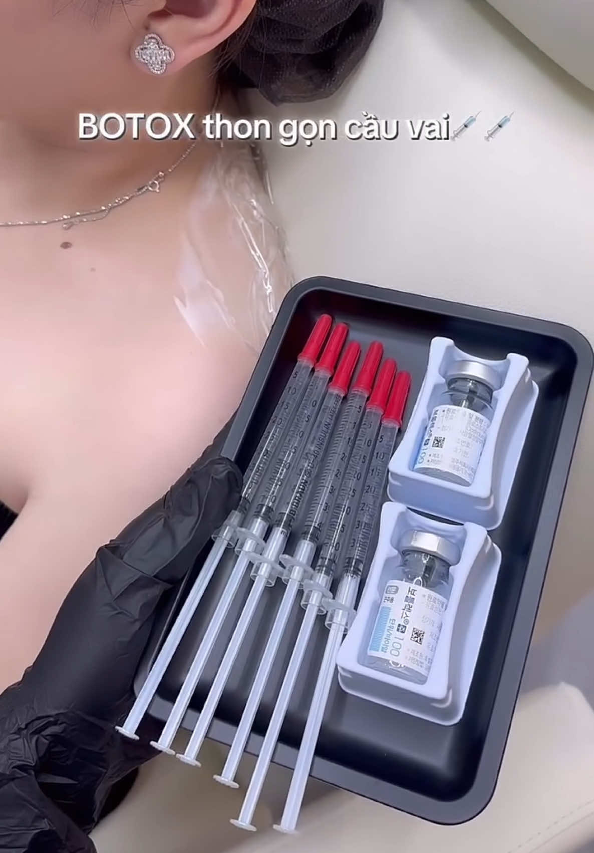💉 TIÊM HẠ CƠ CẦU VAI – BẮP TAY THON GỌN  💉Với chị em có bả vai ngang, cơ cầu vai phát triển to, mặc áo 2 dây hay váy trễ vai thường bị “thô” và mất đi sự nữ tính.  Chỉ với một lần tiêm hạ cơ cầu vai:  • Vai trở nên thon gọn, mềm mại và thanh thoát hơn  • Giúp bắp tay nhỏ gọn, không còn cảm giác to thô  • Tự tin diện mọi outfit: từ áo 2 dây, váy trễ vai đến áo cưới quyến rũ #tienleacadamy #tienle #filler #botox 