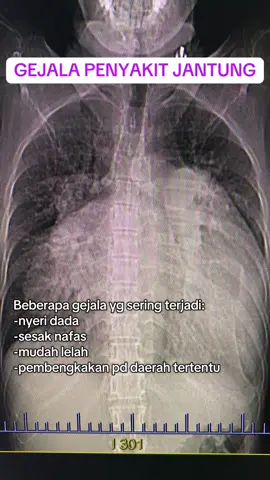#sakitjantung #ctscan #cathlab #radiology 