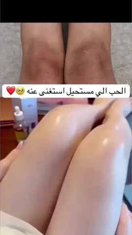 #تصبغات_البشره_بقع_كلف_ #ترند_تيك_توك #تصبغات_البشره_بقع_كلف_ #خلطات_تبييض #تصبغات 