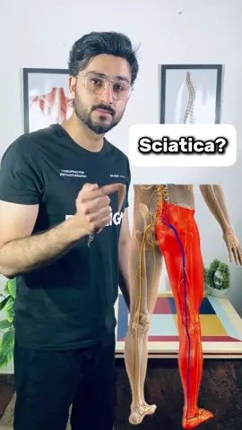 Sciatica Pain relief best exercises ✅ For Appointment: 03368404328 Address: F-7 Markaz Islamabad  #sciatica #sciaticarelief #sciaticatreatment #backpain #discbulge    