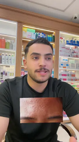 فد شي هاي العصاره ✅#كوزمتك360 #علي_بن_ابي_طالب_أمير_المؤمنين💔 #نصائح_مفيدة #علي_بن_ابي_طالب_أمير_المؤمنين 