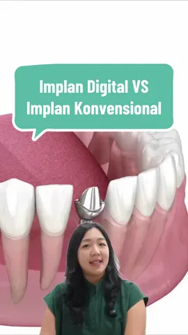 Masih bingung bedanya implan gigi digital dan konvensional? Sini dijelasin dokter gigi spesialis Tanam! Tanam udah menggunakan teknologi canggih yang membuat perawatan implan kamu jadi lebih nyaman, cepat & akurat⚡️ SAVE & SHARE video ini ke temen/keluarga yang mau benerin gigi ompong! #GigiOmpong #DigitalImplant #ImplanGigiDigital #ImplanGigi #TanamGigi 