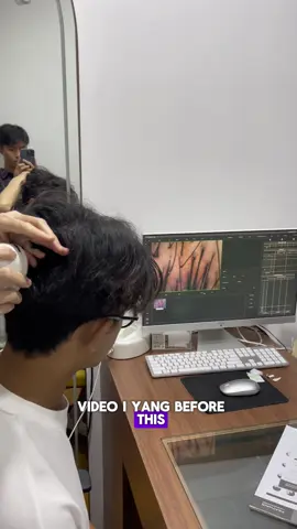 confuse nak pilih hair care yang mana? Tengok video ni sampai habis! #Hairgrowth #rambutgugur #alternativeminoxidil #LabOnHair #hairtok 