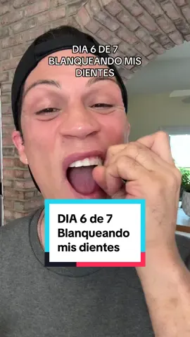 Dia 6 de 7 blanqueando mis dientes con mos #gurunandawhiteningstrips  Tienen aceite coco para una blanquealo gentil y efectivo para que tengas dientes mas blancos.  #blancamientodental #dientesblancos #dientes #blancamientodedientes 
