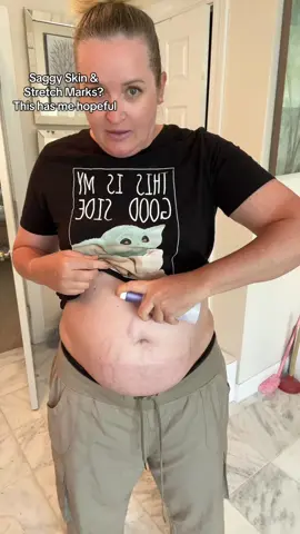 As a mom of 6 kids, this has me shook!!! @Gopure just launched a belly tightening and firming cream and I’m already seeing results in just 7 days!!! If you know this brand you know they’re famous for their neck, arm, and thigh lifting cream, so I won’t be surprised if this belly firming cream flies off the shelves! #bellyfirmingcream #bellytighteningcream #gopure #stretchmarks #fupa 