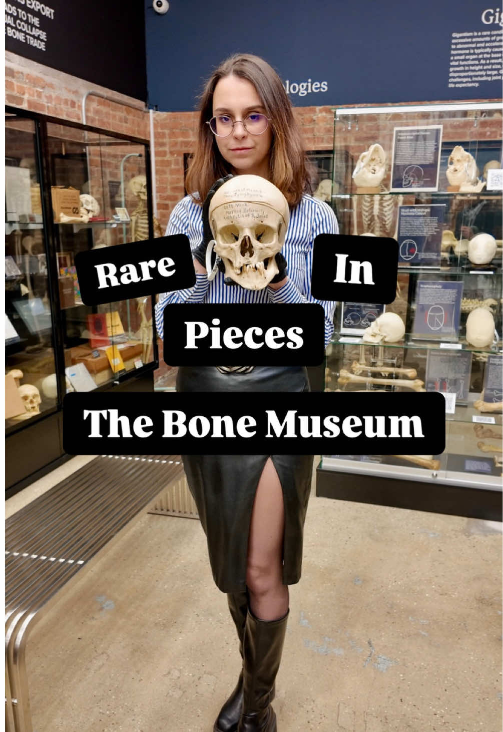 Step into a realm where history and science converge at The Bone Museum, located in the heart of Brooklyn, New York. Our latest video showcases some of our most extraordinary new additions: a dramatic malunion femur fracture with over five inches of displacement, a mandible with a severely broken jaw, and a haunting disarticulated human skull. Of course, no tour of the museum would be complete without a cameo from Bone Jovi, our beloved museum cat and unofficial mascot, who keeps careful watch over the collection. These remarkable specimens alongside countless others reveal the powerful stories bones can tell, from trauma and pathology to the enduring mysteries of medical history.