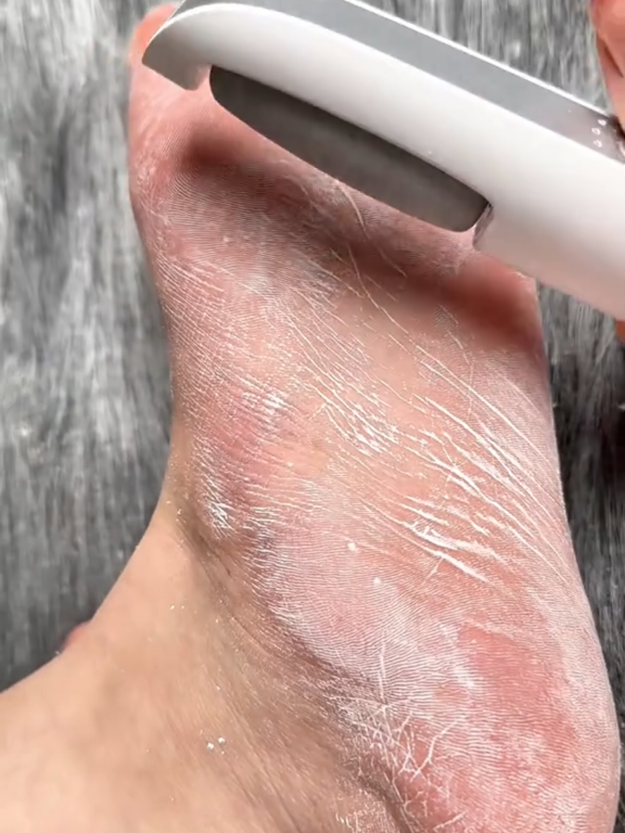 🔥 Lixador de Pé Elétrico - Esfoliador Tira Calos Pedicure Portátil Marisa Lixa Elimina Calo Portátil Usb Pilha . #viral #creatorsearchinsights #esfoliador #fixador #pé 