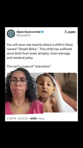 Zionists want you to believe  starving Palestinian children are just ‘sick.’ No. Famine is being manufactured by Israel. Denying food and medicine is not policy, it’s a war crime. #🍉 #starvation #famine #sickchildren #zionists  