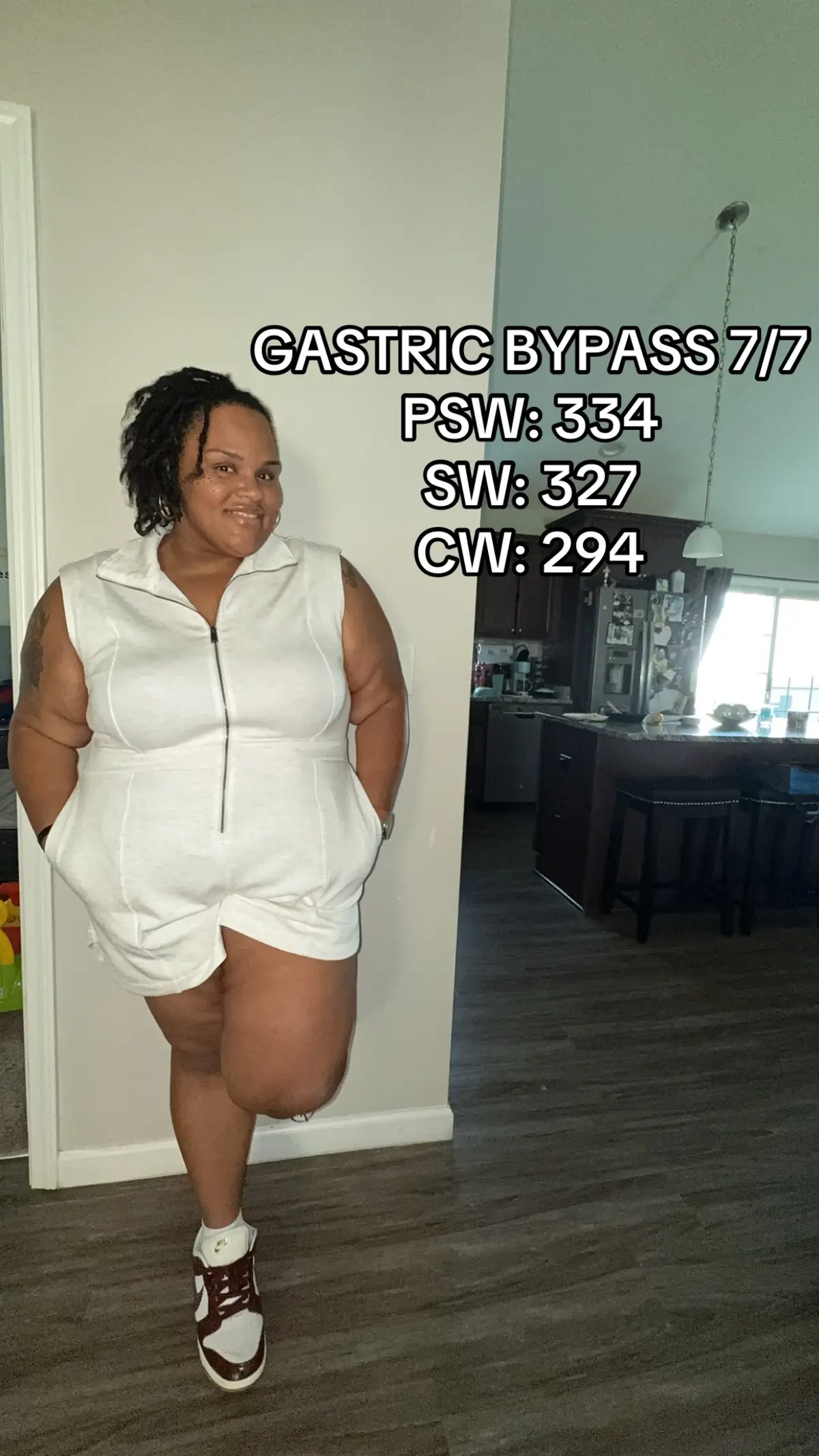 Gastric bypass girlies let’s be friends