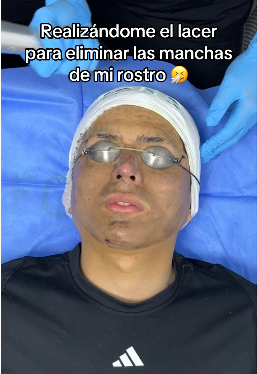 @Beau Centro Estético @Cirugía Estética Fong @Dr Fong Estético #brayansoto 