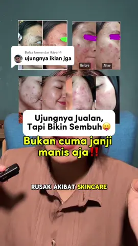 Saya ujung ujungnya jualan bikin sembuh, dari para penjahat penghancur wajah. #skincare #edukasiskincare #skincarebpom #ownerskincare 